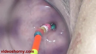 Uterus Bottomless pit with Objects, Pumping Cervix Prolapse
